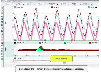 BFB HRV